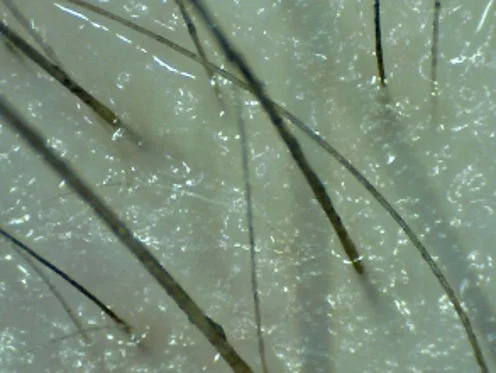 頭皮と毛髪の拡大画像