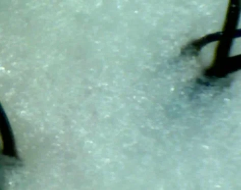 顕微鏡で拡大された毛髪の画像