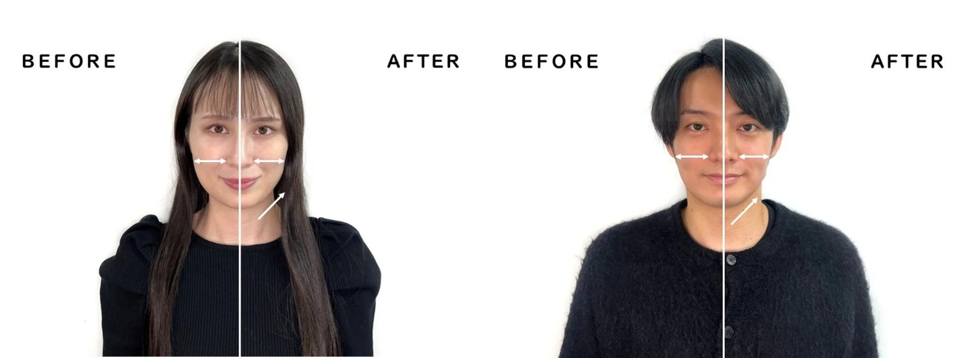 ビフォーアフター