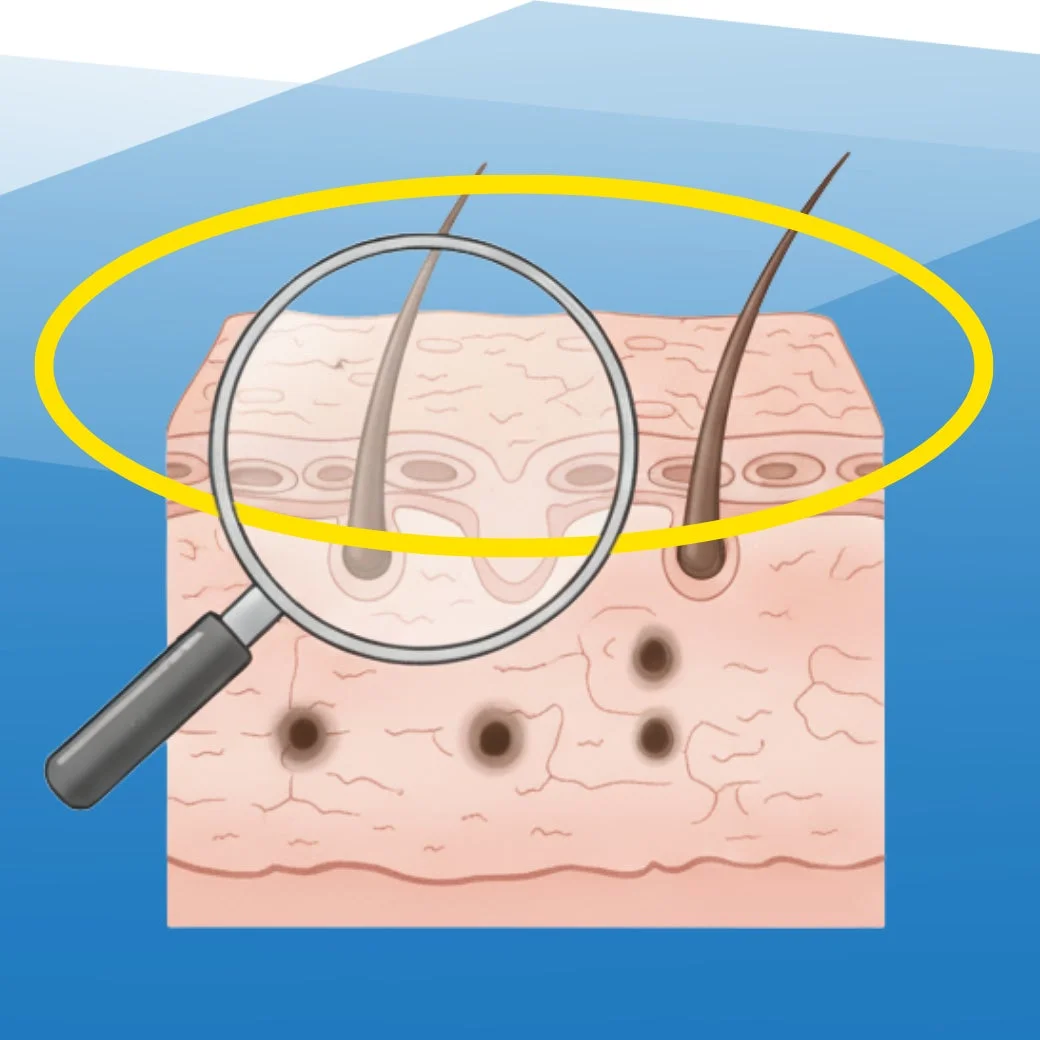 皮膚の断面図と毛髪の構造