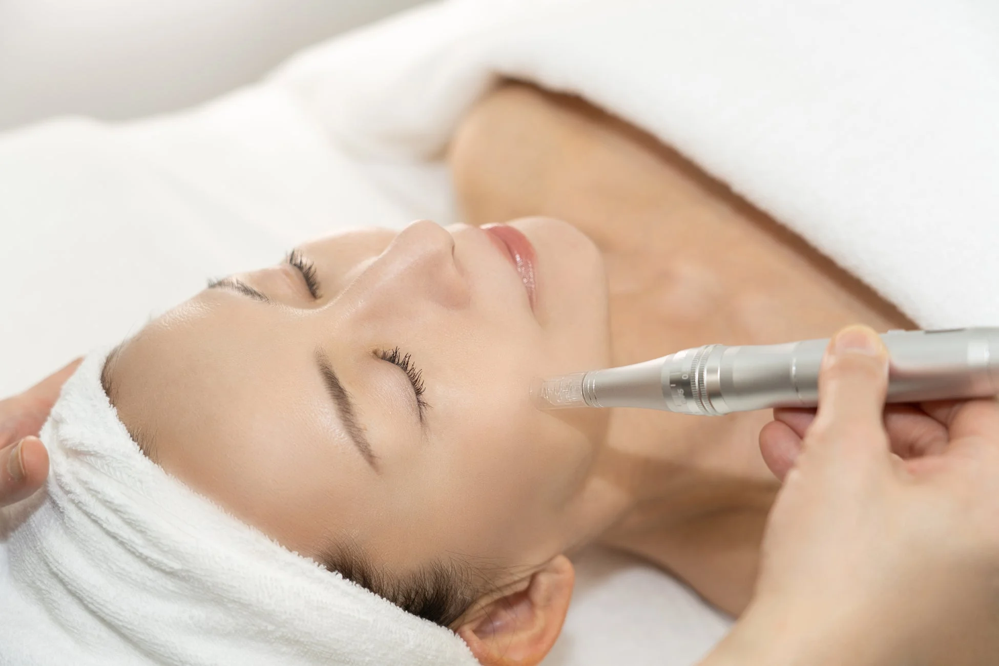 ソフトダーマペンの施術イメージ