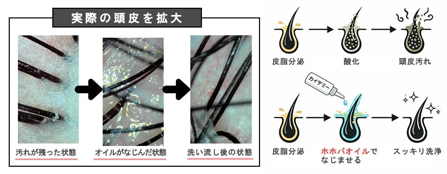 頭皮の汚れがオイルで落ちる過程