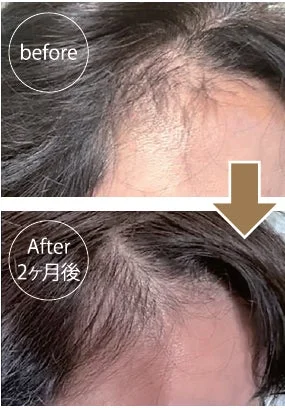 50代女性モニターのビフォーアフター