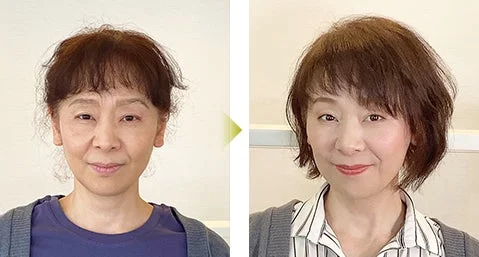 ビフォーアフター1