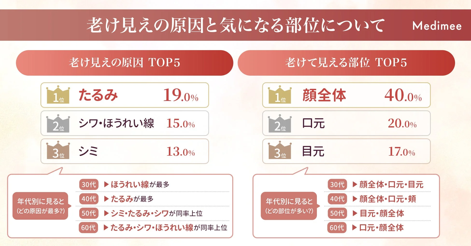 「老け見えの原因と気になる部位」に関するアンケート結果を示すインフォグラフィックです。老け見えの原因TOP3は「たるみ」「シワ・ほうれい線」「シミ」で、老けて見える部位TOP3は「顔全体」「口元」「目元」と示されており、年代別の傾向もまとめられています。