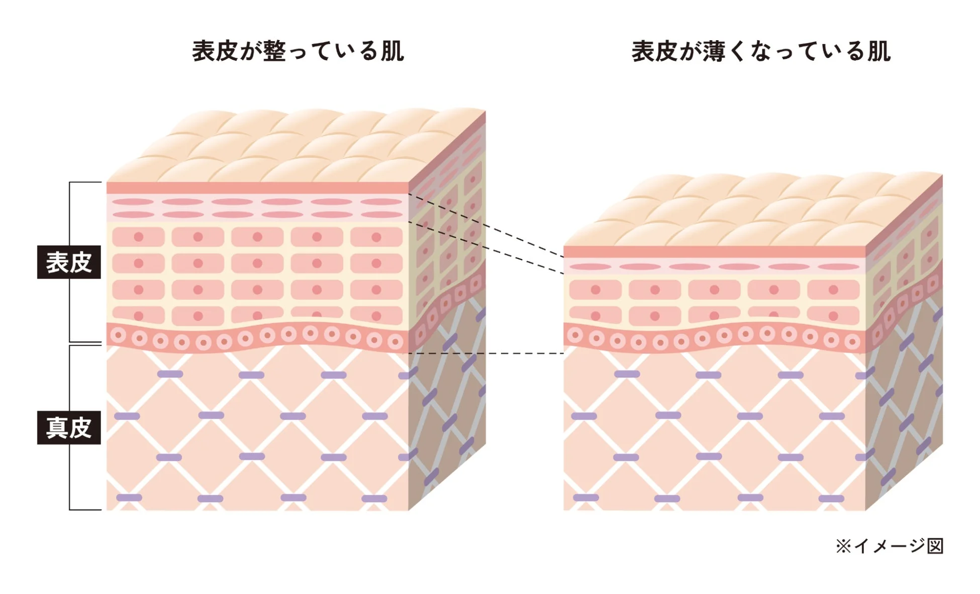 肌の構造イメージ